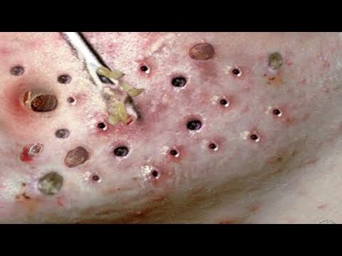 Relaxing Everyday With Loan Nguyen Skincare