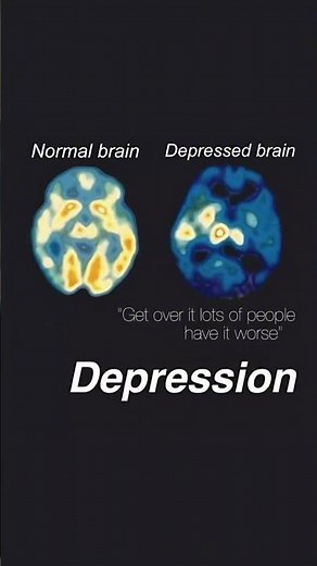 What Mental Disorders Look Like on Brain Scans (Doctor Explains)