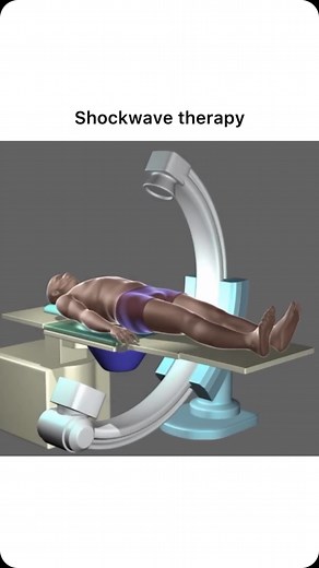 Animations on Instagram: "Follow @surgicalanimation for more! 🏥"