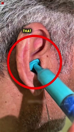 How Custom Hearing Devices Work 😮