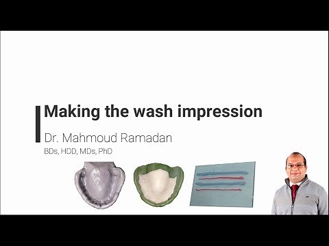 17- Final impression of upper arch. Part 3: Making the wash impression
