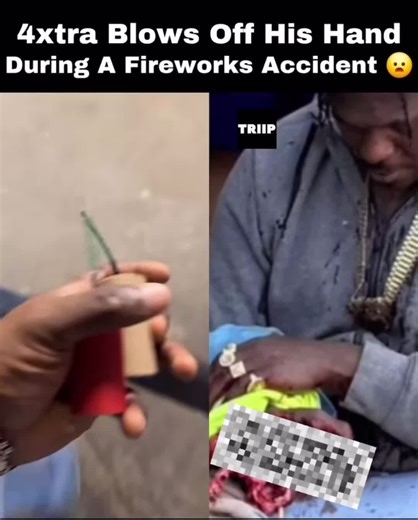 Fireworks Accident: 4 Extra Blows Hand Off