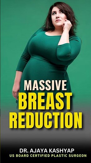 Heavy Breasts & Back Pain? Massive Breas-t Reduction Explained! 🩺 #shorts #gigantomastia