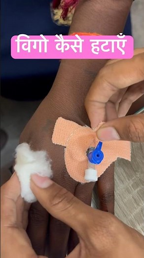How to remove Iv cannula