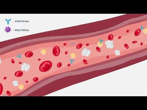 ¿Cuál es la estructura normal de una inmunoglobulina (anticuerpo)?