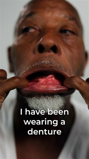 6K views · 24 reactions | 醴✨ From Dentures to Permanent Teeth in Just...