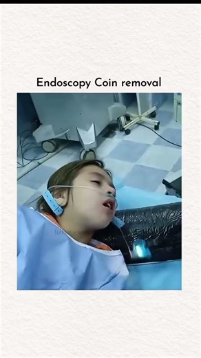 Endoscopic foreign body (coin) removal procedure
