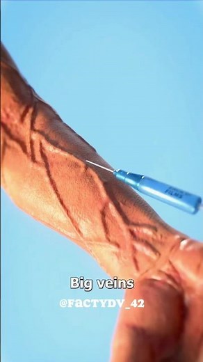 How to Administer Injections Safely: A Step-by-Step Guide"