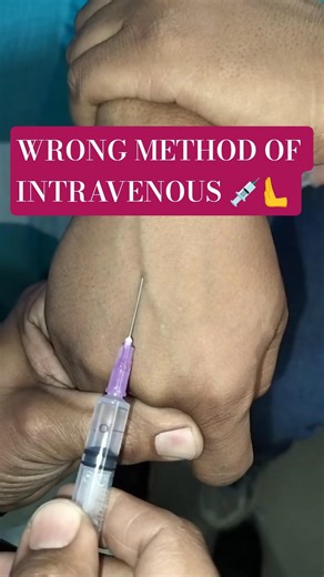 IV Insertion: The "2mm Rule" You Weren't Taught! 💉🚀 #shorts #medicalshorts #trending