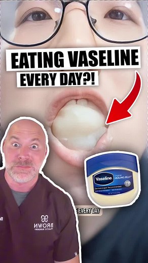 Risks of Eating Vaseline Daily: Health Implications