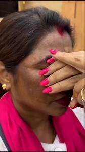 Remove Dark Spots & Pigmentation Naturally At Home . . . #darkspots #pigmentation #darkspotsremoval #skincare #skincareroutine #reelsviralシ #fbreels2025ツ #fbreelsvideo #fypreels #fbreelsfypシ゚viralシ #exploremore #fypageシ | Natural Beauty Remedy