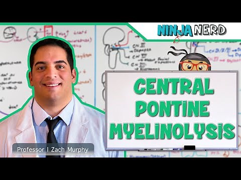 Central Pontine Myelinolysis | Osmotic Demyelination Syndrome