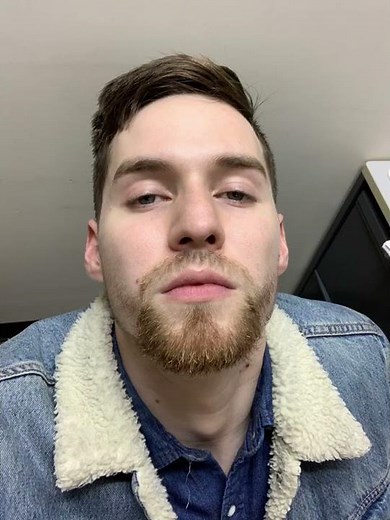 3 Month Patchy Beard Growth
