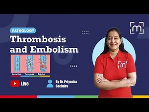 Thrombosis and Embolism with Dr. Priyanka Sachdev
