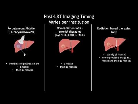 36. Hepatocellular Carcinoma: LI-RADS Treatment Response after locoregional therapy - Part 1