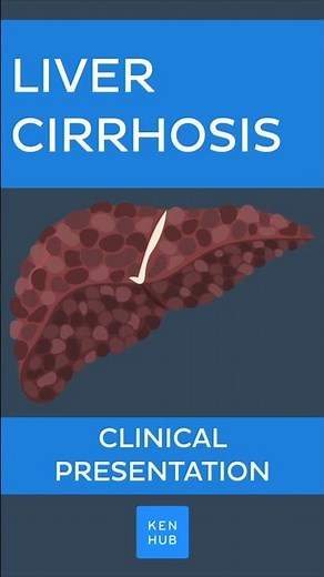 Liver cirrhosis: Clinical presentation | Kenhub #livercirrhosis