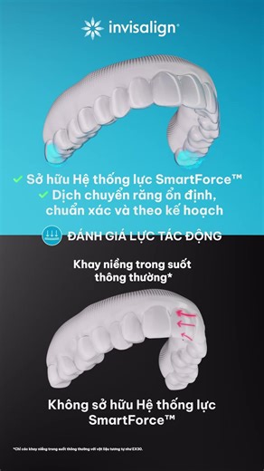 INVISALIGN – 5 Tiêu Chí Làm Nên Sự Vượt Trội