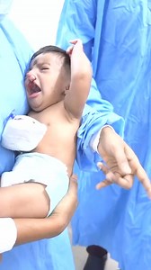 2.6M views · 39K reactions | Rare Cleft Baby Going under Sleep Anesthesia | Doctor Give birth | Facebook
