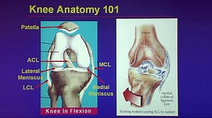 VIDEO: Common Traumatic Knee Injuries: “Oh, My Aching Knee”