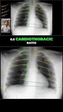 CHEST X-Ray Critique (Case 4, Part 3)