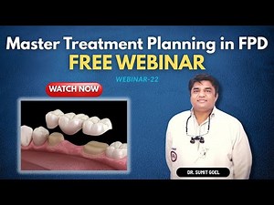 Webinar - 22 | Master Treatment planning in FPD By Dr. Sumit Goel | Free Weekly Webinar for Dentists