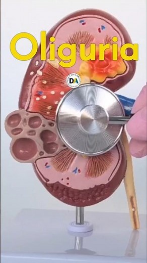 ¿Conoces El Origen y Significado de La Palabra OLIGURIA?