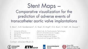 Stent maps – Comparative visualization for the prediction of adverse events of transcatheter aortic valve implantations