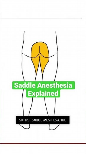 Saddle Anesthesia Explained