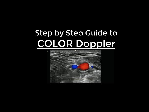 How to use Color Doppler on Ultrasound - Step by Step Guide