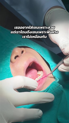 ตึงๆ🥹 #คลินิกทันตกรรมอะไลน์ #คลินิกทันตกรรม #คลินิกทําฟัน #ตรวจฟันฟรี #จัดฟัน