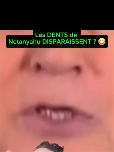 Les dents de Netanyahu : Disparition ou IA ?