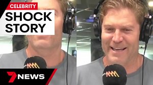 Dr Chris Brown reveals embarrassing way he broke his arm