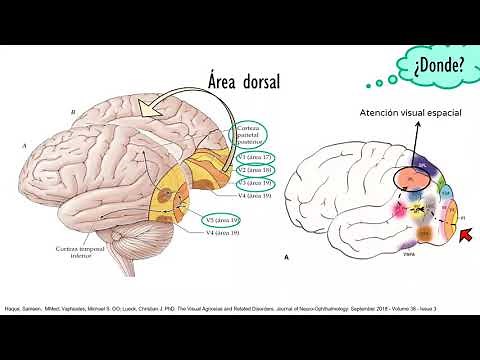 Agnosias visuales