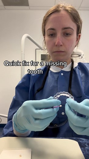 Quick Fix for Missing Tooth: Impo Dentufix