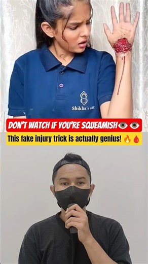 Her fake wound looks TOO real⁉️@Shikhasart3