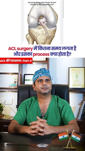 ACL Surgery में कितना समय लगता है और इसका Process क्या होता है ? | Dr Neeraj Srivastava