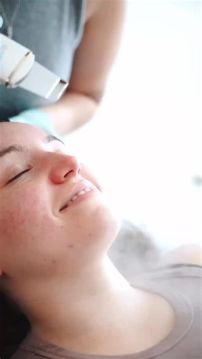 Our little magic wand to make extractions more comfortable? The ultrasonic skin scrubber 🪄 This tool allows us to loosen and lift away dead skin cells, oil, and blackheads from the pores with high-frequency vibrations! The easiest way to think of it: it’s shaking out the gunk from within the pores 👏🏼 Add extractions onto any facial for just $20 extra! Your esthetician will use the extractions method(s) best suited for your unique skin & comfort level 💕 #facials #esthetician #extractions #sco