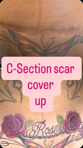 Tatz By B4nk| Local Celebrity Tattoo Artist on Instagram: "Turning “battle scars” into body art one C‑section cover‑up at a time. Moms, I got you. Booking Mommy makeovers all next year! Tap in Family merry Christmas ✍🏽🌹🌹 #explorepage #fyp #tattoo #viral #tattoos"