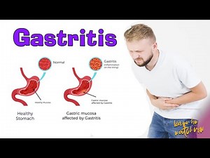 Gastritis | Causes | Signs and symptoms | Foods to avoid gastritis