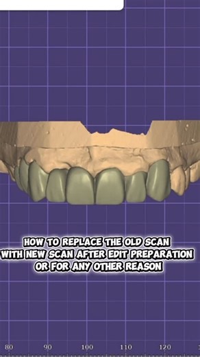 Mohamed shehab on Instagram: "Exocad tips English subtitles ✨❤️#dentaltechnician #dental_student #exocad #dentallaboratrory #dentist #explorepage #explore"