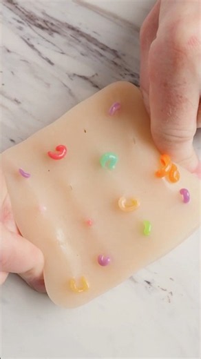 Why Are Pimples Only Black and White?