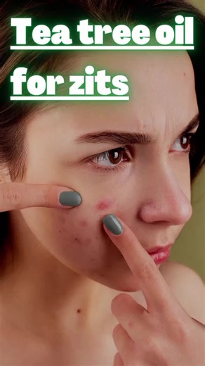 Tea tree oil for zits? #skincare #skincareroutine #skintok #skincaretips #tiktok