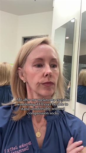 Incorporating Compression Socks into Daily Life