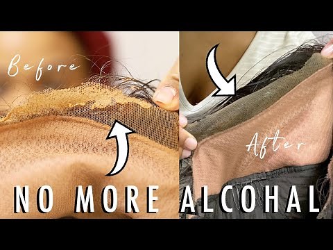 HOW TO: Safely REMOVE GLUE off your lace wig AND SKIN | EASY & QUICK & SAFE