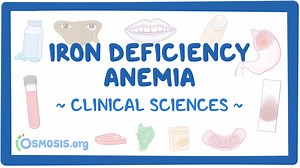 Iron deficiency anemia: Video & Meaning | Osmosis