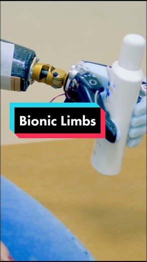 Advancements in Bionic Limbs: A Look at Modern Prosthetics
