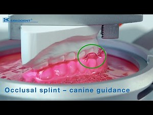 Occlusal splint – canine guidance