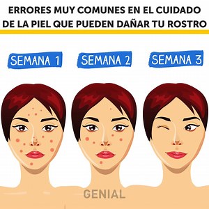 449K views · 1.7K reactions | Errores muy comunes en el cuidado de la piel que pueden dañar tu rostro: | Ideas en 5 minutos | Facebook