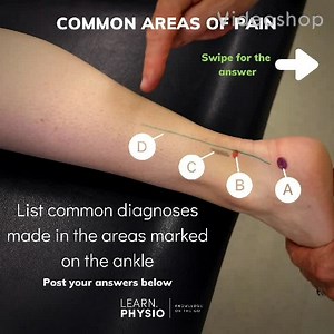 1.8K views · 24 reactions | Achilles Tendon pain - Not always...