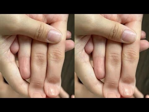 A moment's carelessness, a lifetime of regret